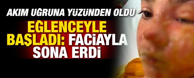 Akım uğruna y&uuml;z&uuml;nden oldu!