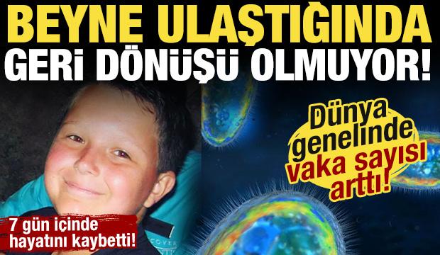 D&uuml;nyada hızla yayılıyor! Beyne ulaştığında geri d&ouml;n&uuml;ş&uuml; kalmıyor! 7 g&uuml;n i&ccedil;inde &ouml;ld&uuml;...