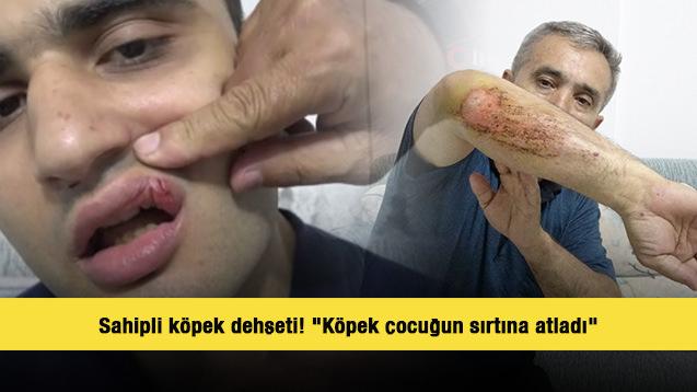 Sahipli k&ouml;pek dehşeti! Baba ve otizmli oğlu yaralandı 