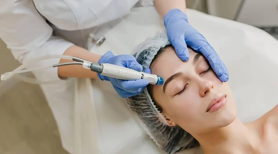 Cildi gen&ccedil;leştirmenin sırrı: Kadınların yeni g&ouml;zdesi kolajen arttıran dermapen işlemi!