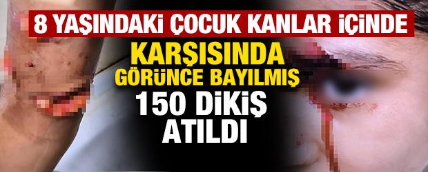 Şanlıurfa'da k&ouml;pek dehşeti! 8 yaşındaki &ccedil;ocuk kanlar i&ccedil;inde kaldı 