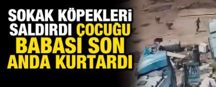 Silopi'de başıboş k&ouml;peklerin saldırdığı &ccedil;ocuğu, babası ve amcası kurtardı
