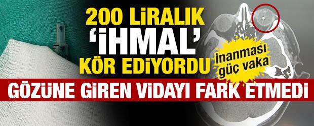İnanması g&uuml;&ccedil; vaka! G&ouml;z&uuml;ne giren vidayı fark etmedi... K&ouml;r oluyordu
