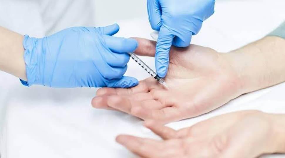 Aşırı terlemeniz varsa doğal olduğunu d&uuml;ş&uuml;nmeyin: Uzman doktorlar tedavi y&ouml;ntemini anlattı
