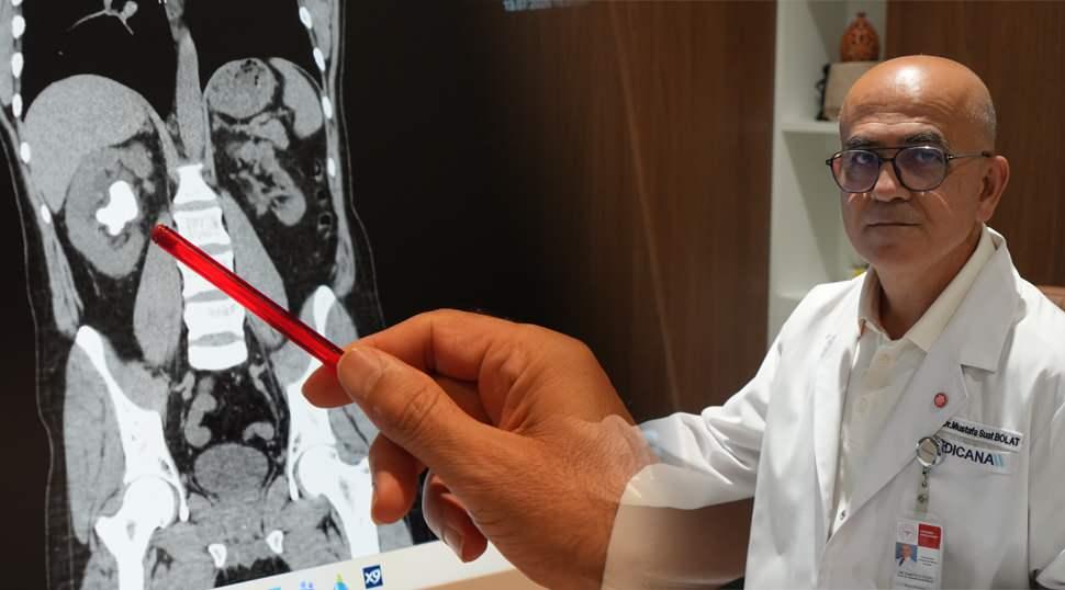 Dev b&ouml;brek taşını sırtından &ccedil;ıkarmak zorunda kaldı: Uzman doktor s&uuml;reci anlattı