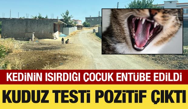 Kedinin ısırdığı 4 yaşındaki &ccedil;ocuk ent&uuml;be edildi! Kuduz testi pozitif &ccedil;ıktı