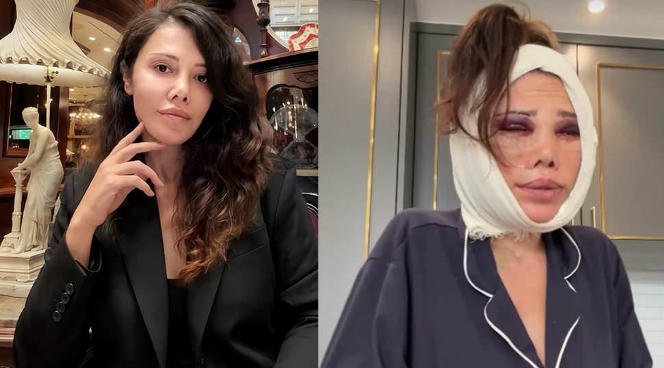 Kore'de iki kez y&uuml;z&uuml;n&uuml; gerdirdi! Didem Ceran'dan yeni ameliyat a&ccedil;ıklaması