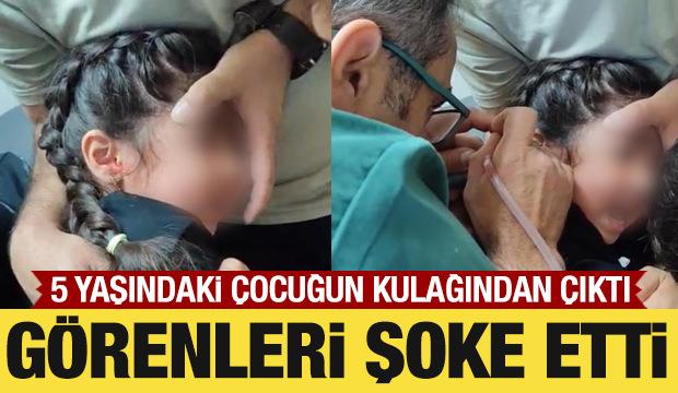 5 yaşındaki &ccedil;ocuğun kulağından canlı kene &ccedil;ıktı