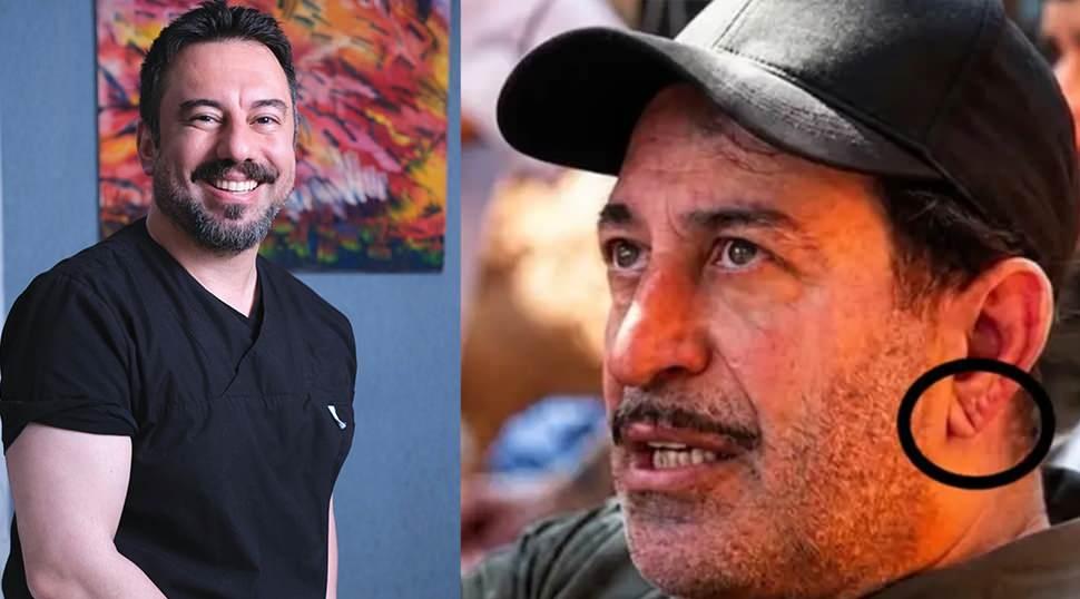 Cem Yılmaz'ın kalp krizi sonrası kulak memesindeki detay g&uuml;ndem oldu! 