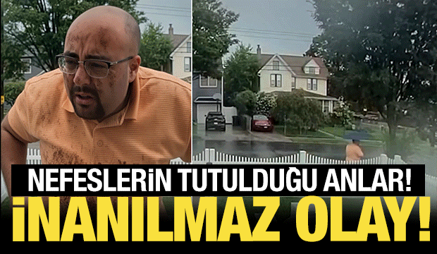 &Ouml;l&uuml;m&uuml;n kıyısından mucizeye! Ağacın altından ge&ccedil;erken yıldırım &ccedil;arptı