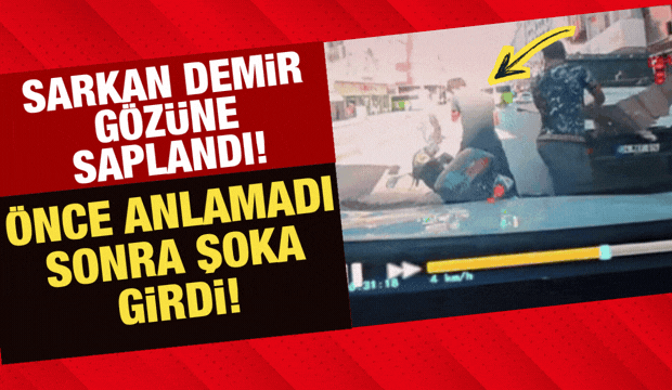 Gebze'deki korkun&ccedil; ihmal kayıtta: Kasadan sarkan demir g&ouml;z&uuml;ne saplandı!