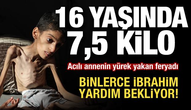 16 yaşındaki Gazzeli İbrahim 7,5 kiloya d&uuml;şt&uuml;