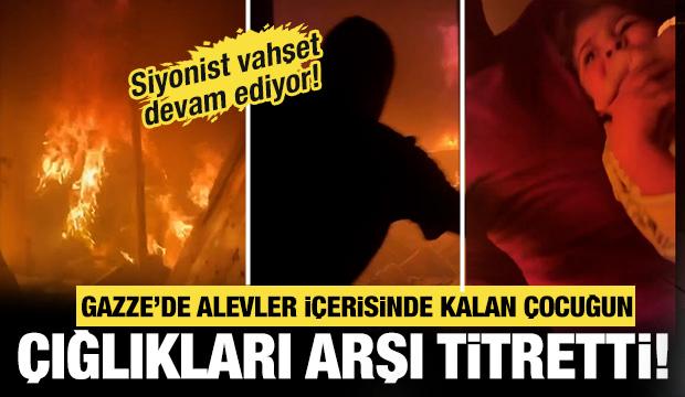 K&uuml;&ccedil;&uuml;k kız alevler i&ccedil;inde kaldı, yardım &ccedil;ığlıkları arşı titretti!