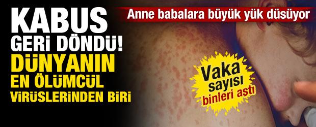 D&uuml;nyanın en &ouml;l&uuml;mc&uuml;l vir&uuml;slerinden biri olan "kızamık" k&acirc;busu geri d&ouml;nd&uuml;!
