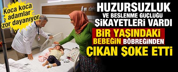 Y&uuml;ksek ateş şikayetiyle hastaneye getirilen bebeğin b&ouml;breğinden 2 santim taş &ccedil;ıkartıldı 