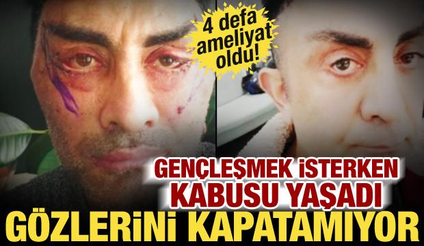 Gen&ccedil;leşmek istedi, hayatı kabusa d&ouml;nd&uuml;! 4 ameliyat oldu, g&ouml;zlerini kapatamıyor