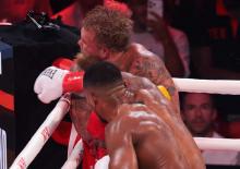 Fenomen boks&ouml;r&uuml;n &ccedil;enesi iki yerden kırılmış: Titanyum plak takıldı