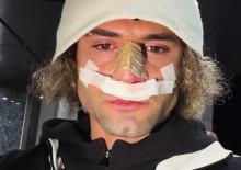 2. Lig'in gol kralının burnu kırıldı! Ma&ccedil;ı bu şekilde tamamladı