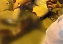 K&ouml;peğine saldıran, pitbull cinsi k&ouml;peğin sahibini 3 yerinden bı&ccedil;akladı 